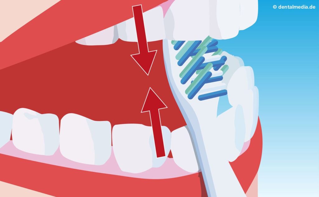 Grafik: Zähneputzen - Innenflächen B