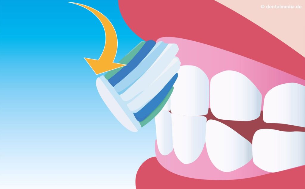 Grafik: Zähneputzen - Aussenflächen B